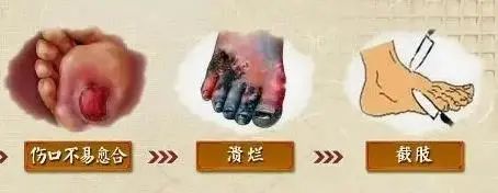 干细胞存储 干细胞存储