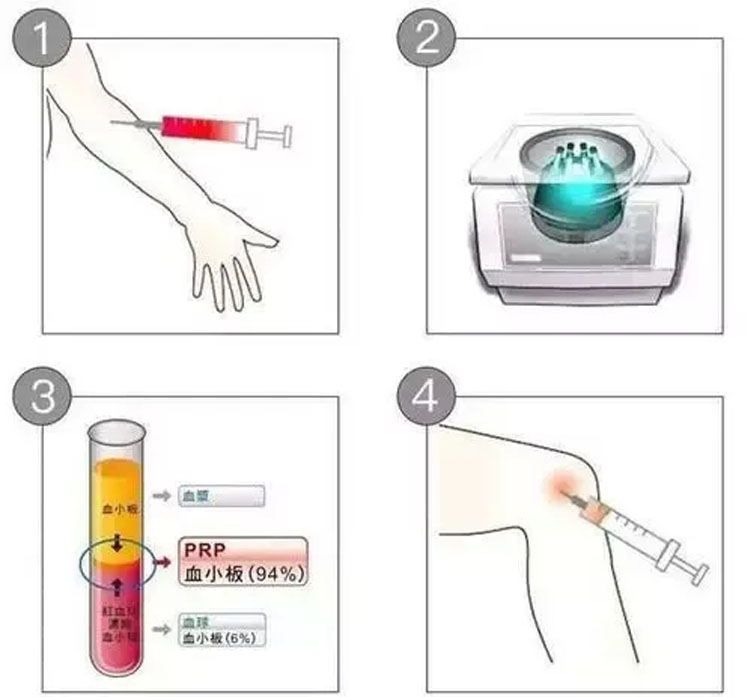 新利体育平台首页登录入口